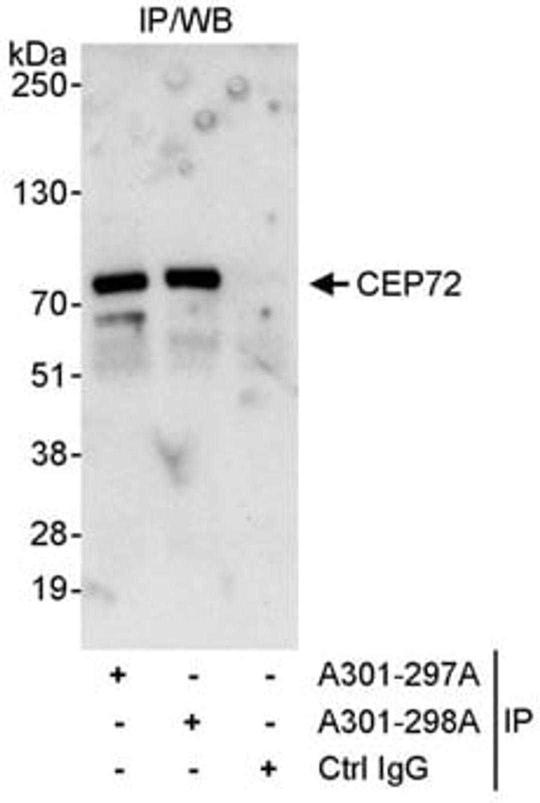 Detection of human CEP72 by western blot of immunoprecipitates.