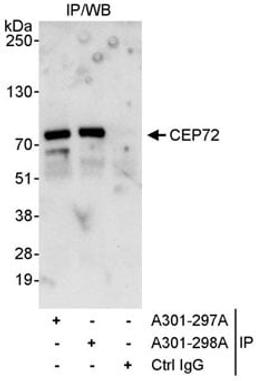 Detection of human CEP72 by western blot of immunoprecipitates.