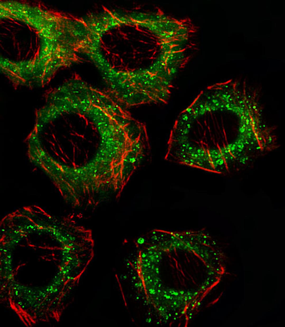 Fluorescent image of A549 cell stained with FADS2 Antibody (N-term). A549 cells were fixed with 4% PFA (20 min), permeabilized with Triton X-100 (0.1%, 10 min), then incubated with FADS2 primary antibody (1:25). For secondary antibody, Alexa Fluor 488 con