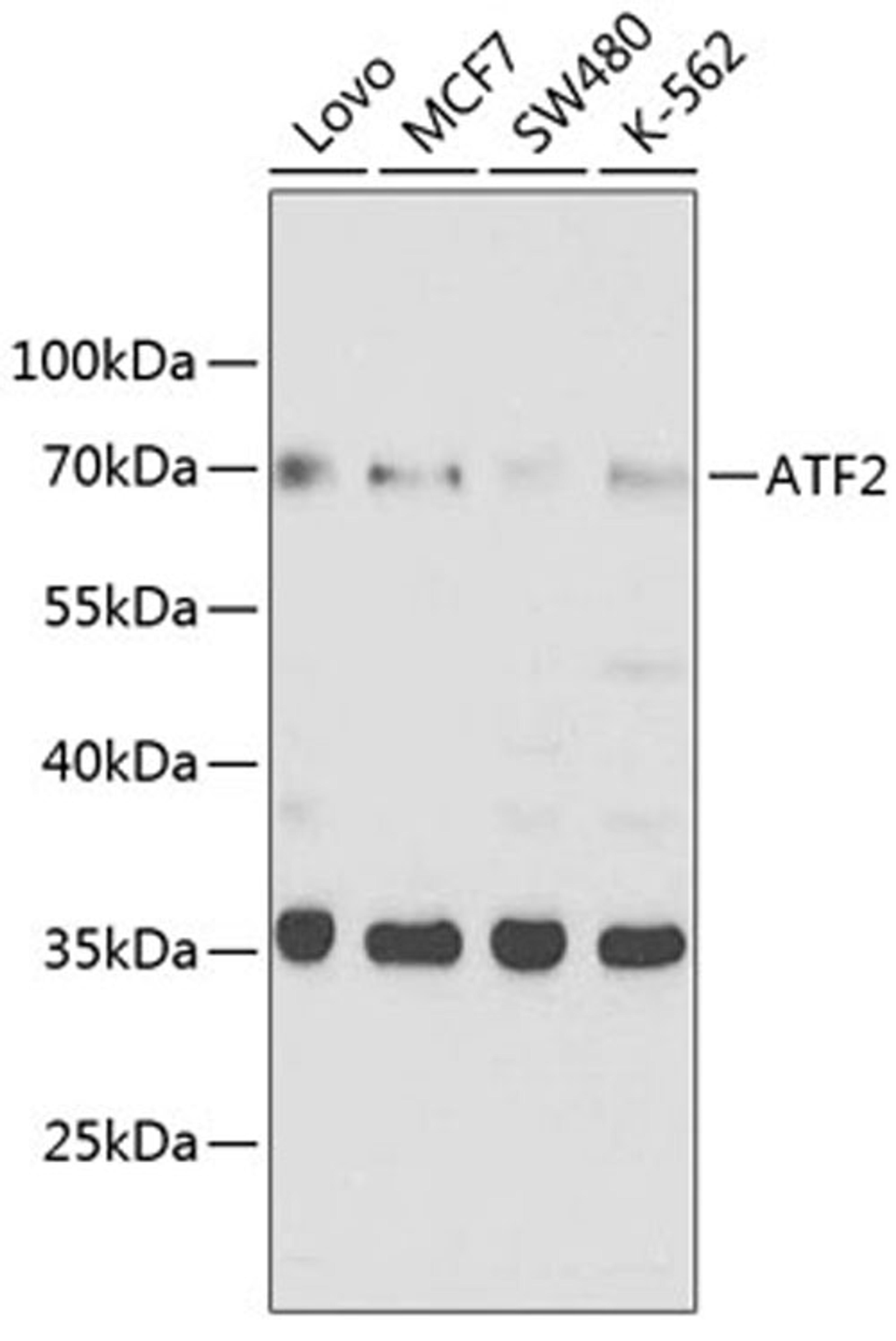 Western blot - ATF2 antibody (A2155)