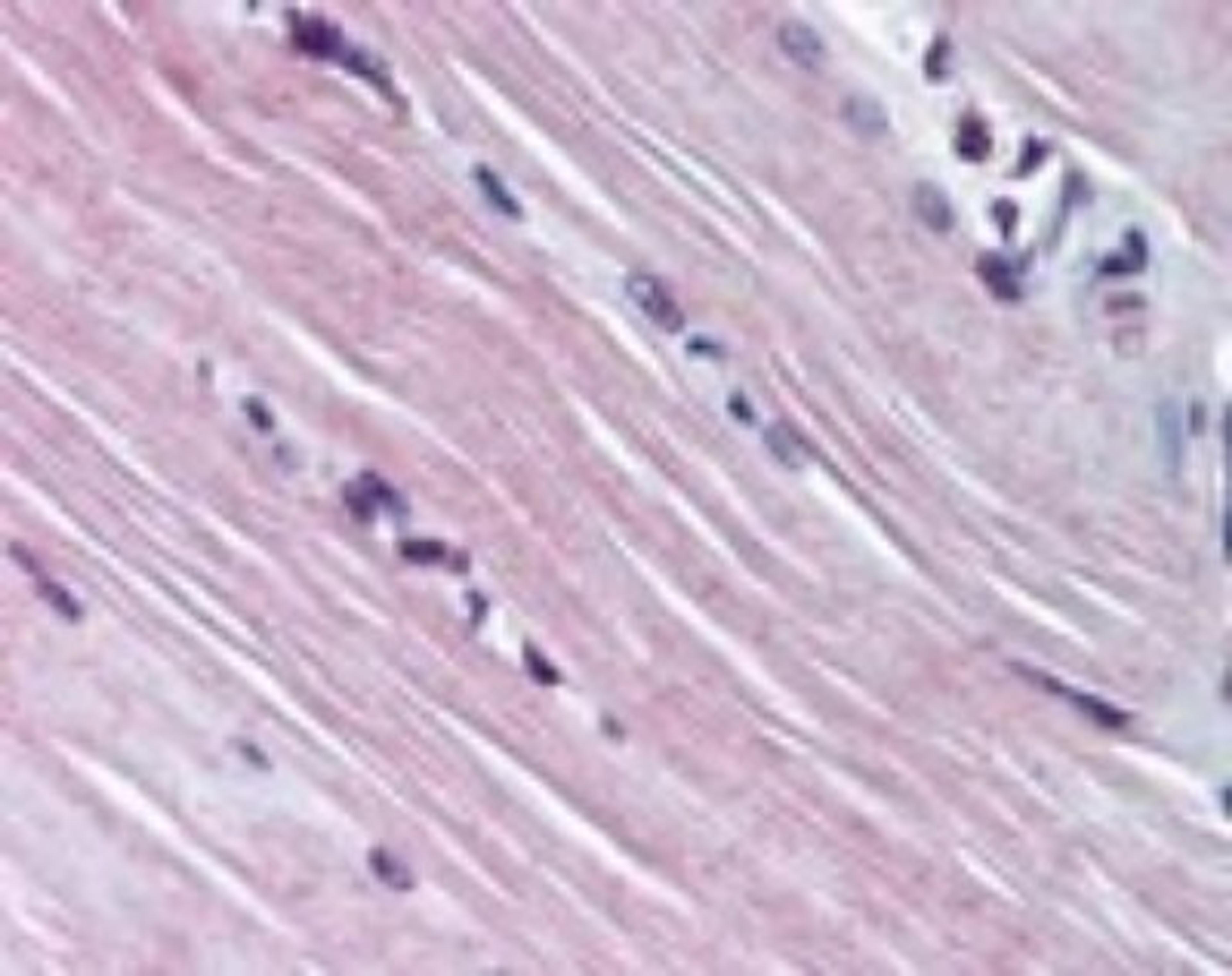 Immunohistochemistry-Paraffin: AMPD1 Antibody [NBP2-24509] - IHC analysis of human skeletal muscle using NBP2-24509 at 10 ug/ml.