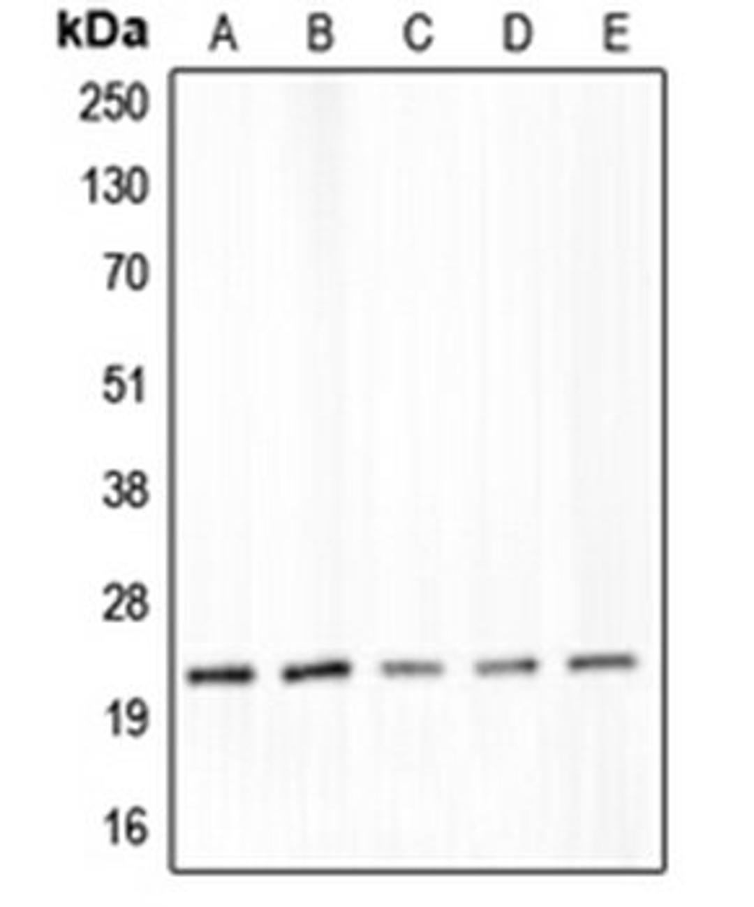 Western blot analysis of DLD (Lane 1), SW480 (Lane 2), LS1034 (Lane 3), MIA (Lane 4), PaCa2 (Lane 5) whole cell lysates using CLDN4 antibody