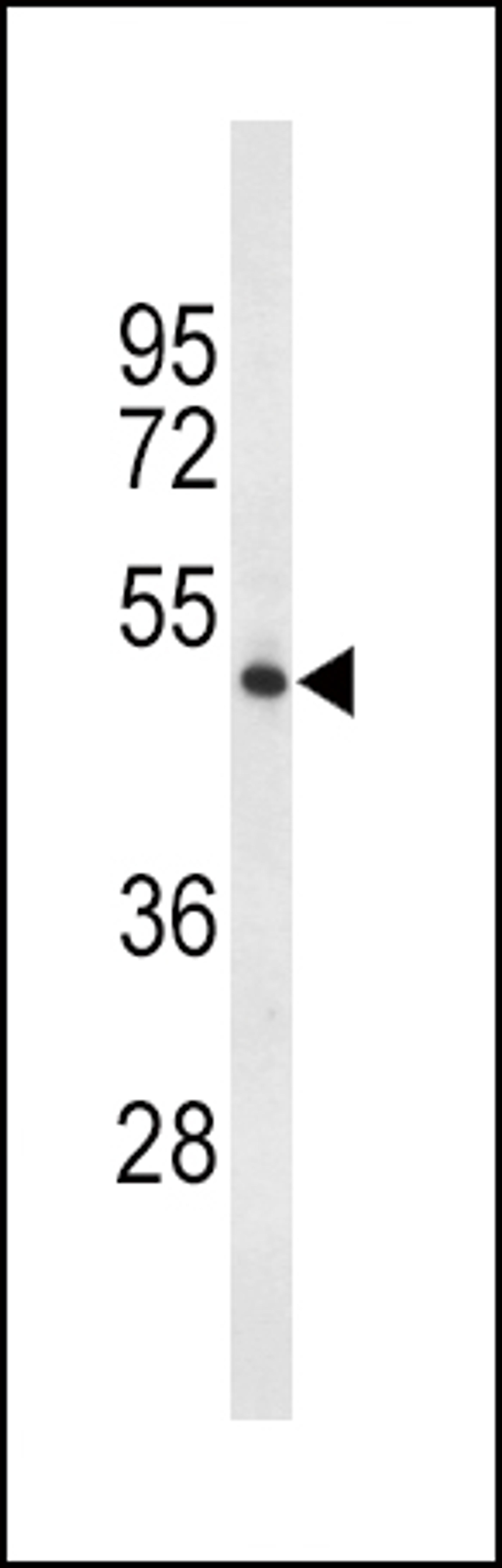 Western blot analysis of TPH2 Antibody in 293 cell line lysates (35ug/lane)