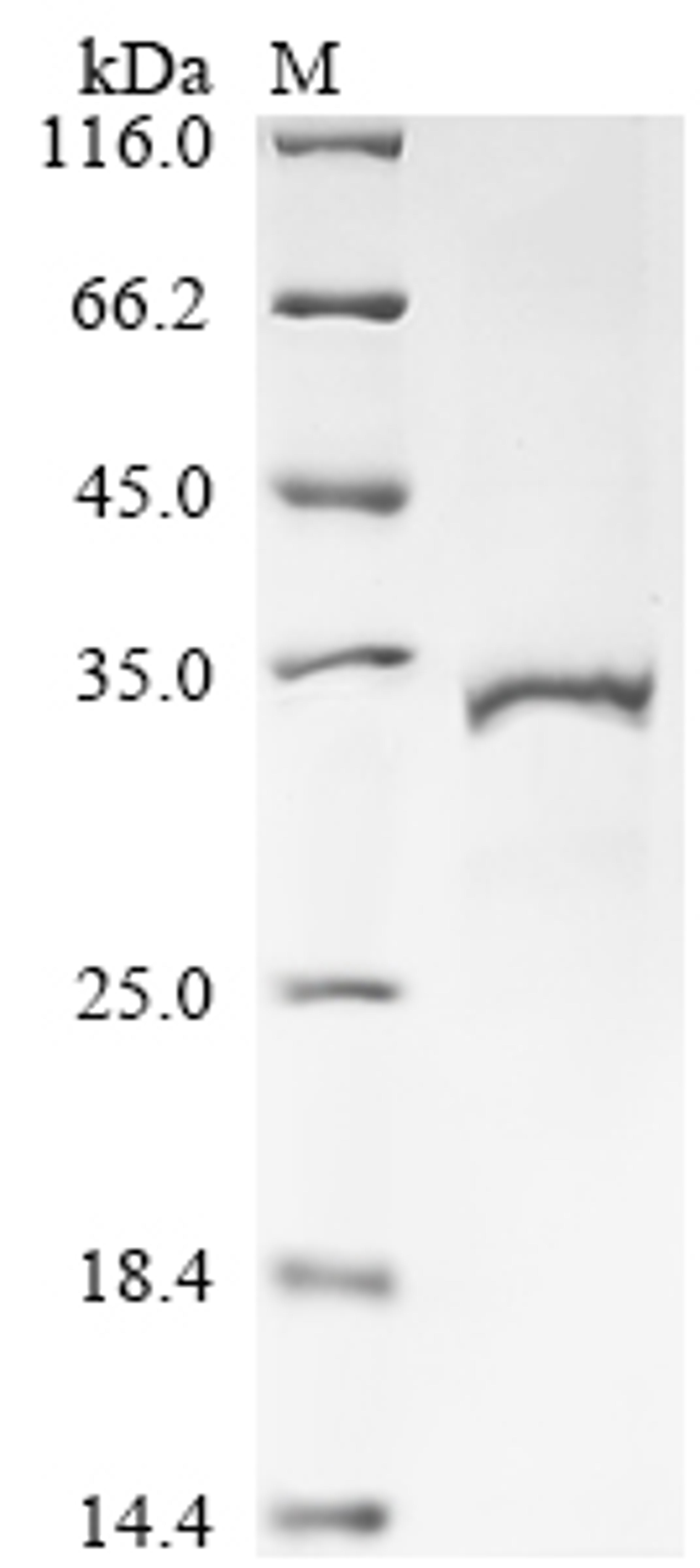 (Tris-Glycine gel) Discontinuous SDS-PAGE (reduced) with 5% enrichment gel and 15% separation gel.