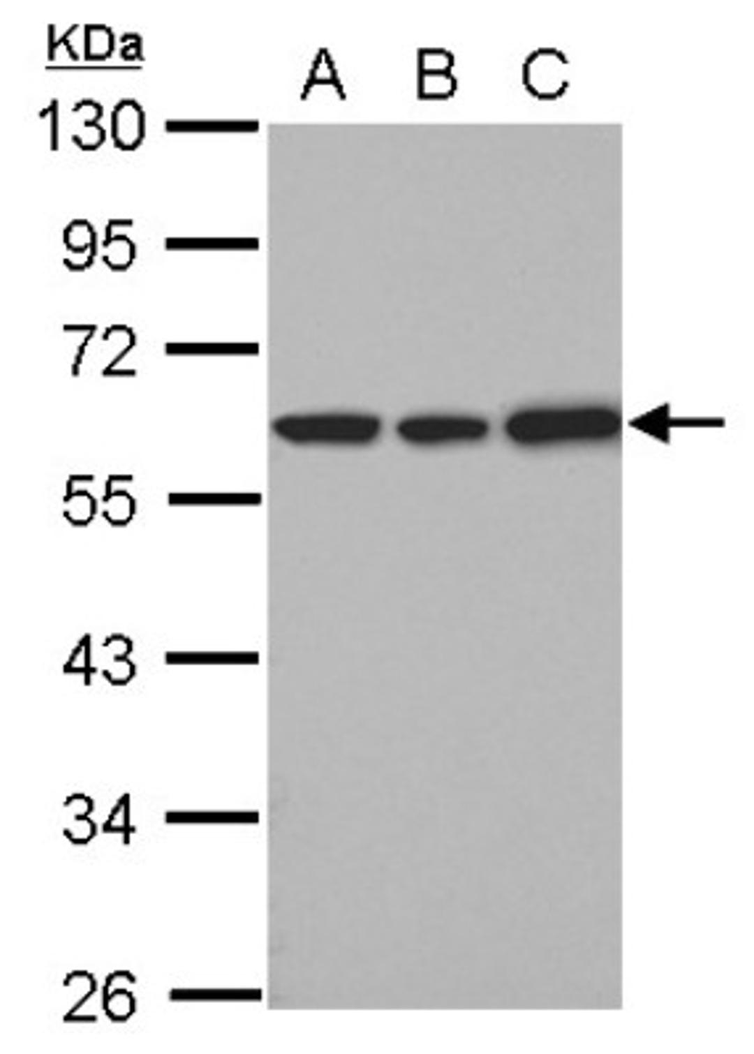 Western Blot: UDP glucose dehydrogenase Antibody [NBP2-20799] - Sample (30 ug of whole cell lysate) A: 293T B: A431 C: HeLa 10% SDS PAGE gel, diluted at 1:1000.