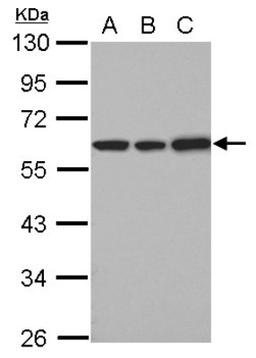 Western Blot: UDP glucose dehydrogenase Antibody [NBP2-20799] - Sample (30 ug of whole cell lysate) A: 293T B: A431 C: HeLa 10% SDS PAGE gel, diluted at 1:1000.