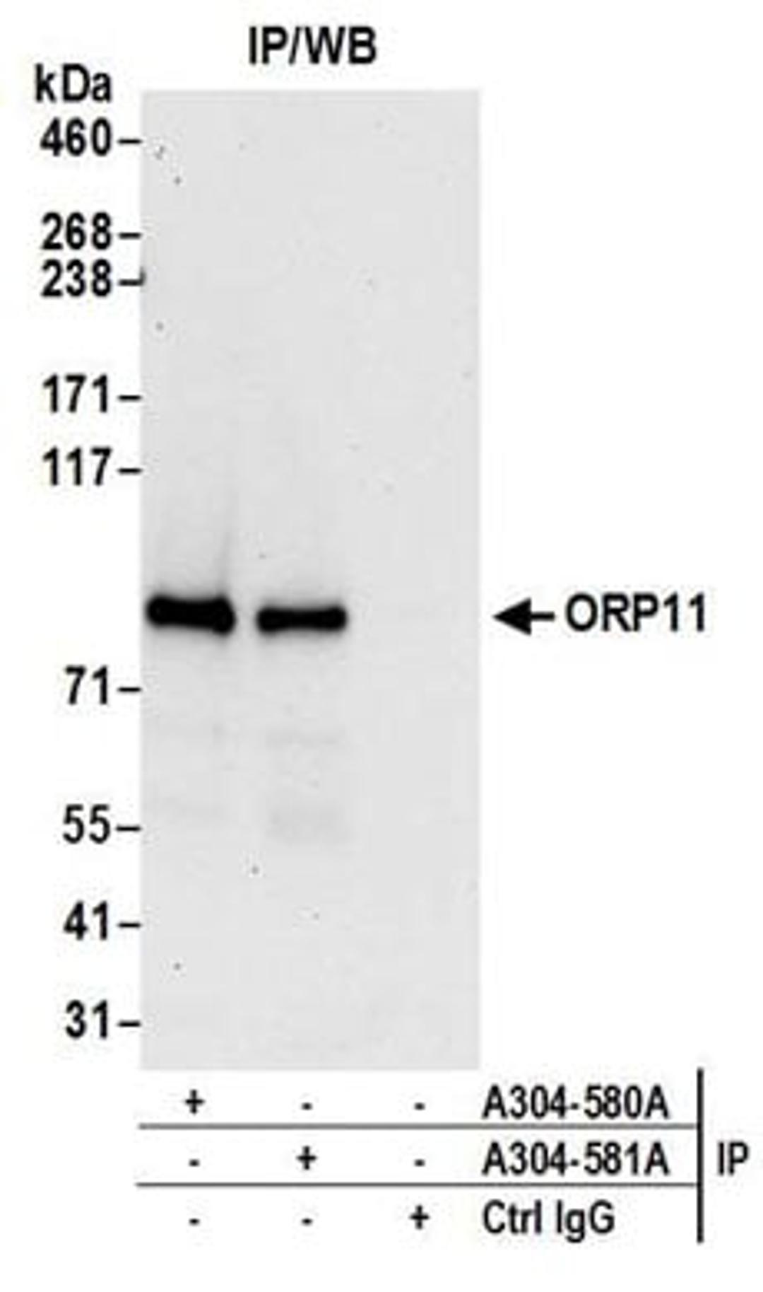 Detection of human ORP11 by western blot of immunoprecipitates.