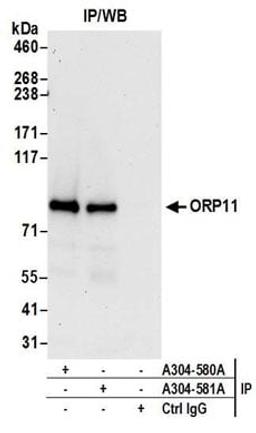 Detection of human ORP11 by western blot of immunoprecipitates.