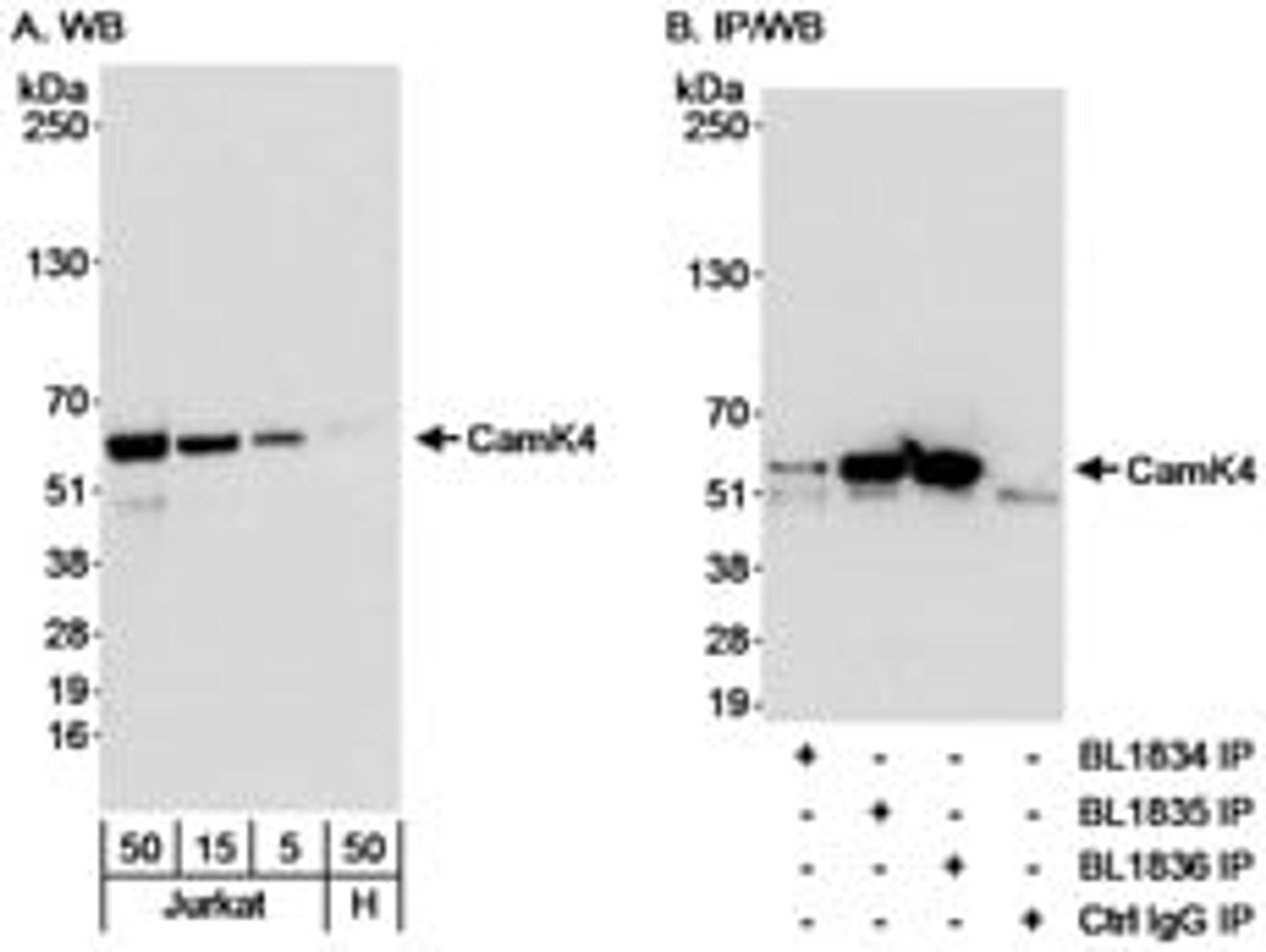 Detection of human CamK4 by western blot and immunoprecipitation.