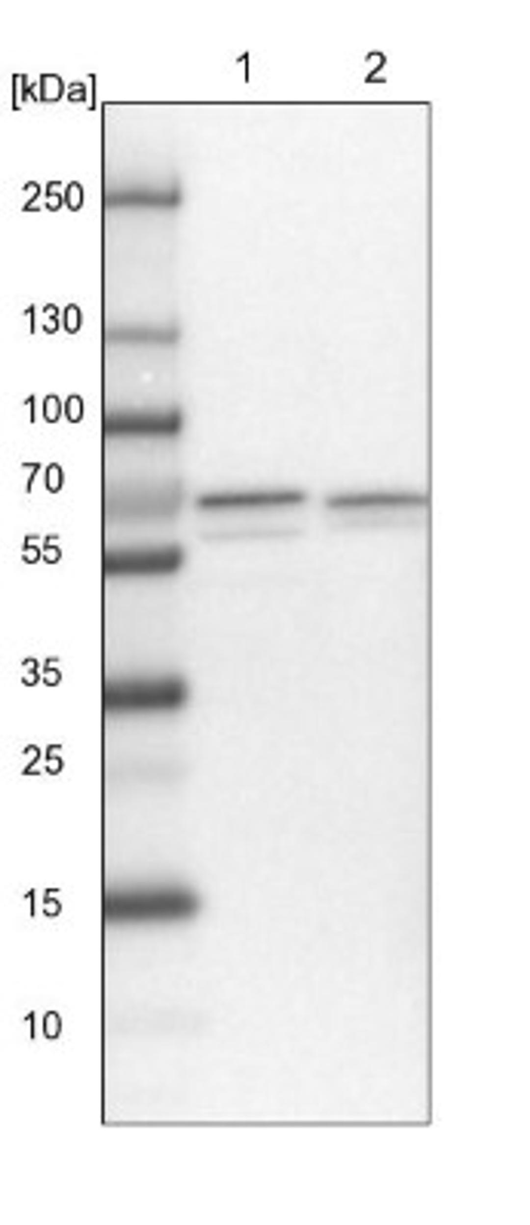 Western Blot: PPIL2 Antibody [NBP1-85360] - Lane 1: NIH-3T3 cell lysate (Mouse embryonic fibroblast cells)<br/>Lane 2: NBT-II cell lysate (Rat Wistar bladder tumour cells)