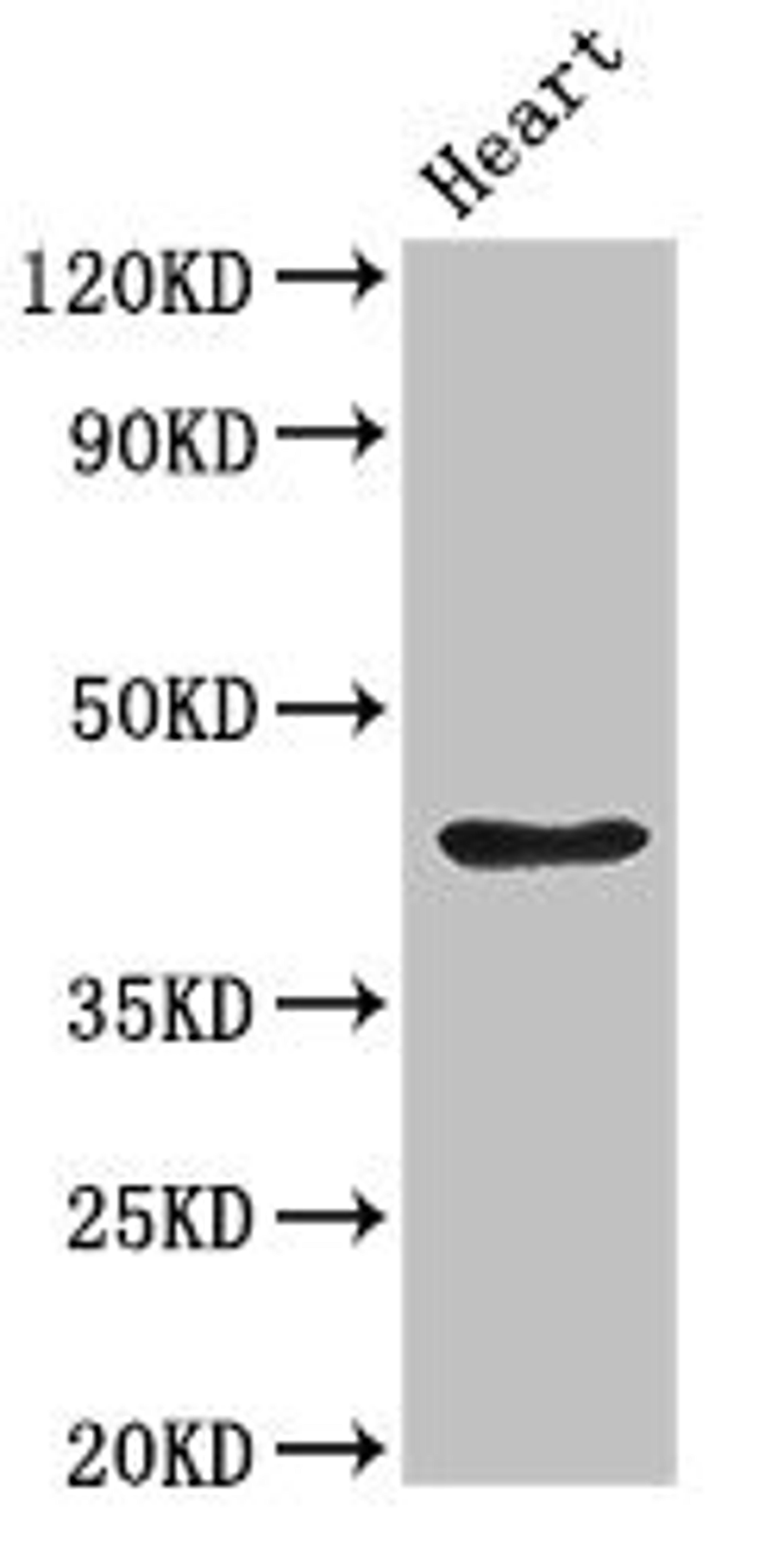 Western Blot. Positive WB detected in: Rat heart tissue. All lanes: PARVA antibody at 2.7ug/ml. Secondary. Goat polyclonal to rabbit IgG at 1/50000 dilution. Predicted band size: 43 kDa. Observed band size: 43 kDa. 