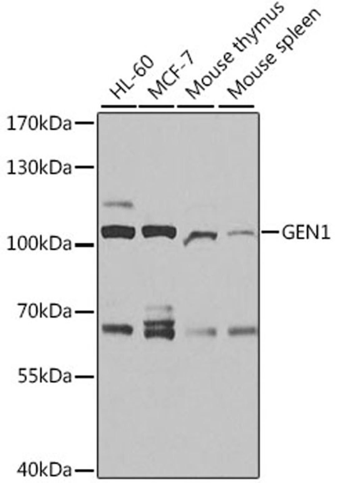 Western blot - GEN1 antibody (A10001)