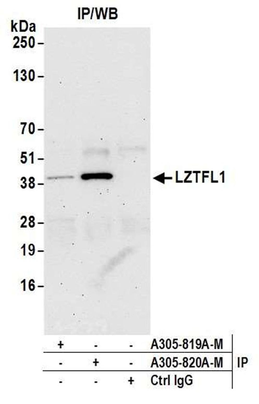 Detection of human LZTFL1 by WB of IP.