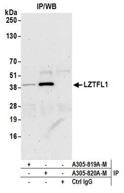 Detection of human LZTFL1 by WB of IP.