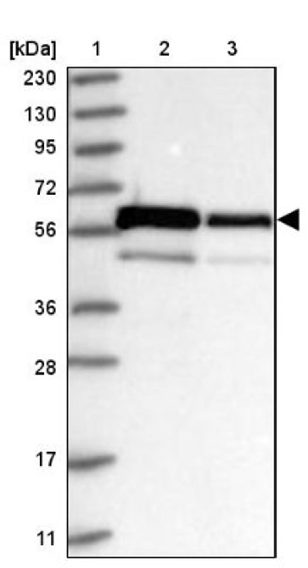 Western Blot: ZNF622 Antibody [NBP1-81183] - Lane 1: Marker [kDa] 230, 130, 95, 72, 56, 36, 28, 17, 11<br/>Lane 2: Human cell line RT-4<br/>Lane 3: Human cell line U-251MG sp