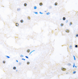 Immunohistochemical staining of human kidney using FOXC1/2 antibody