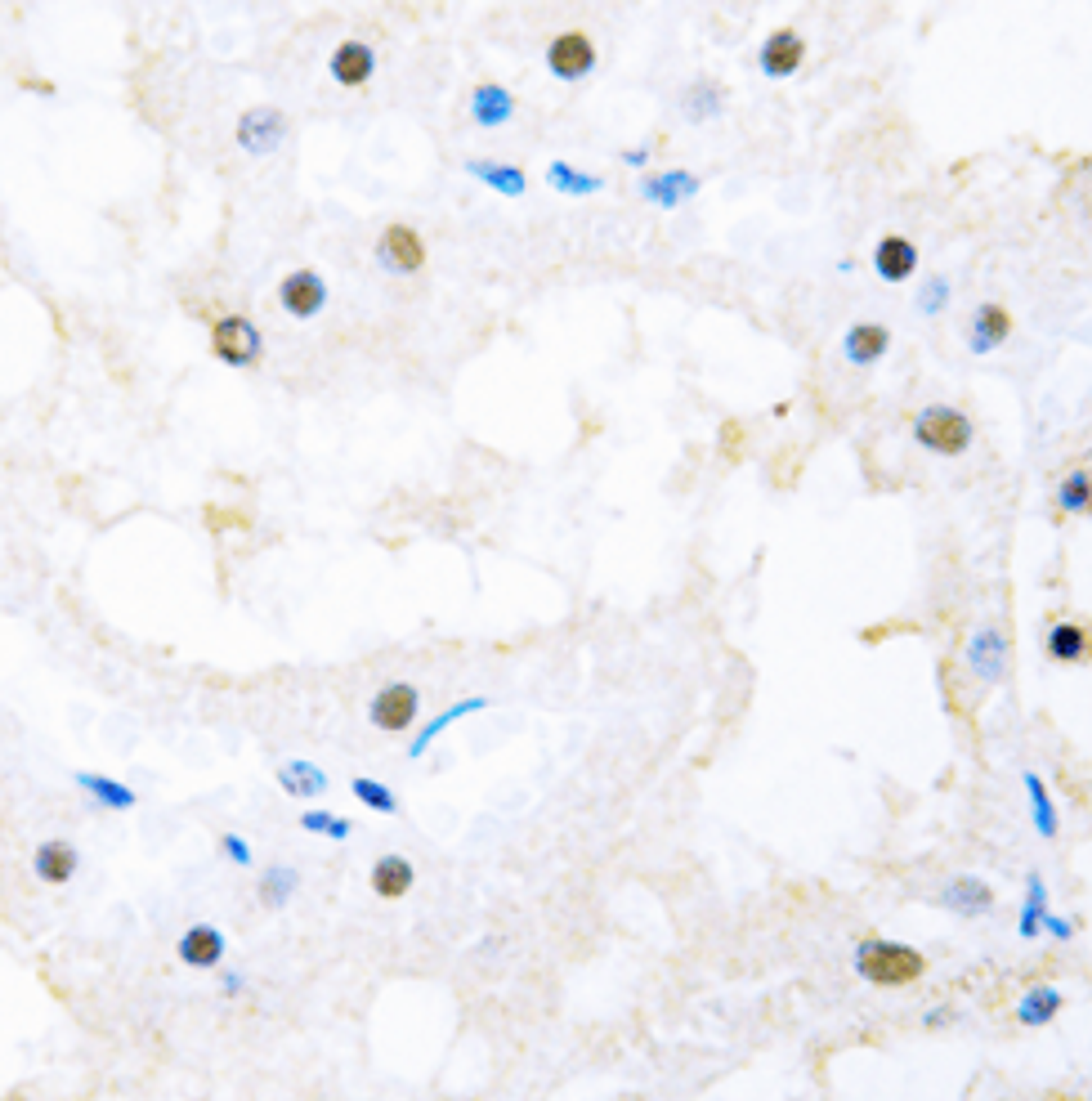 Immunohistochemical staining of human kidney using FOXC1/2 antibody