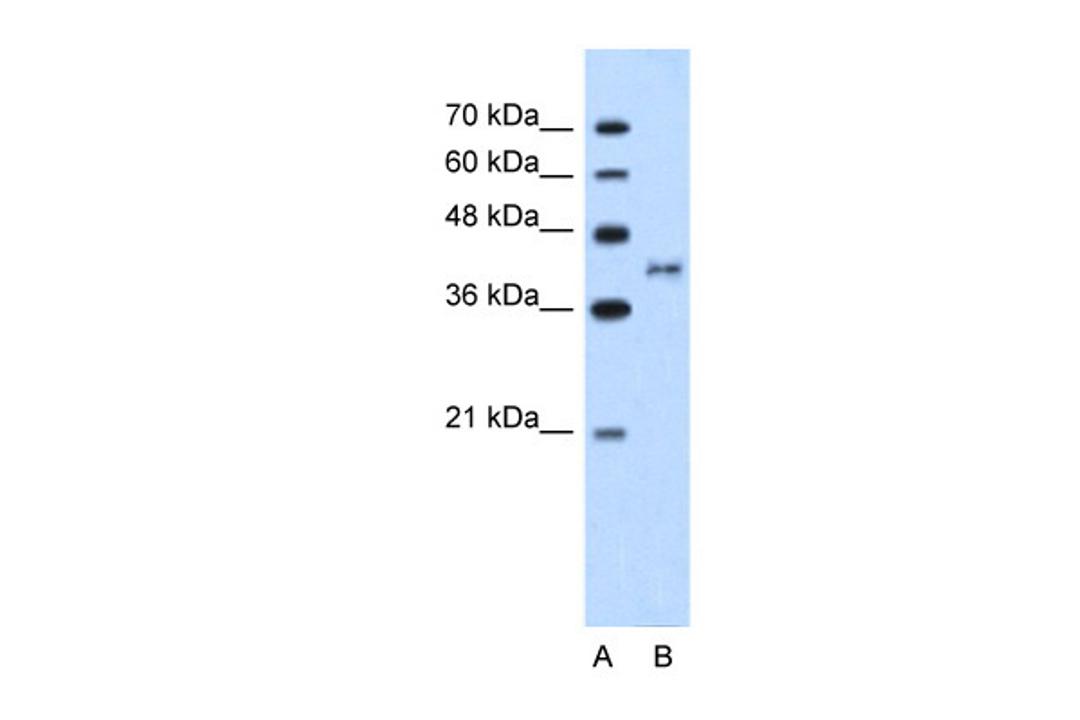 Antibody used in WB on Human Jurkat 5.0 ug/ml.