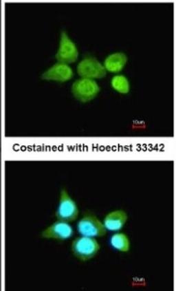 Immunocytochemistry/Immunofluorescence: SSA1 Antibody [NBP1-33548] - Paraformaldehyde-fixed A431, using antibody at 1:200 dilution.