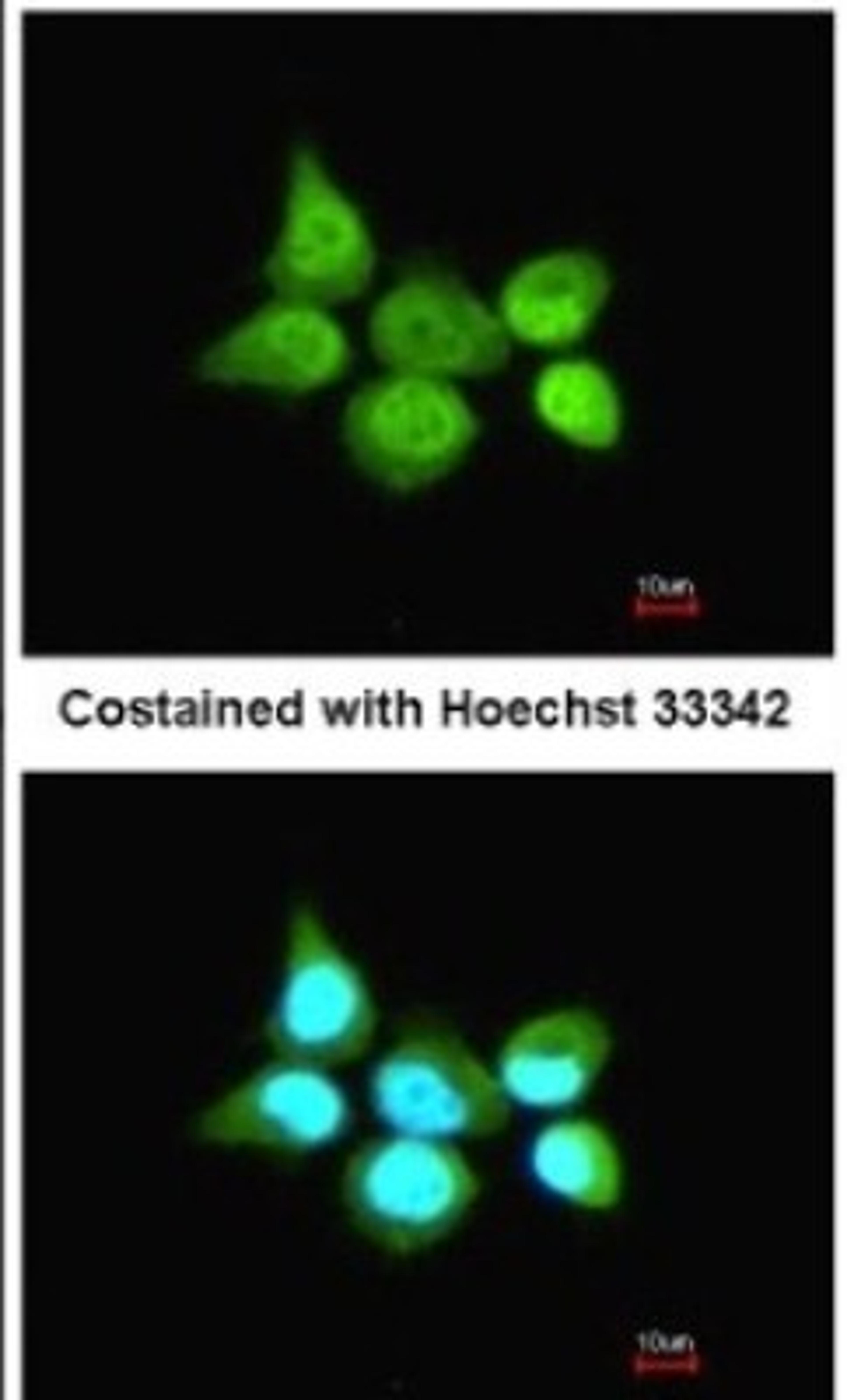 Immunocytochemistry/Immunofluorescence: SSA1 Antibody [NBP1-33548] - Paraformaldehyde-fixed A431, using antibody at 1:200 dilution.