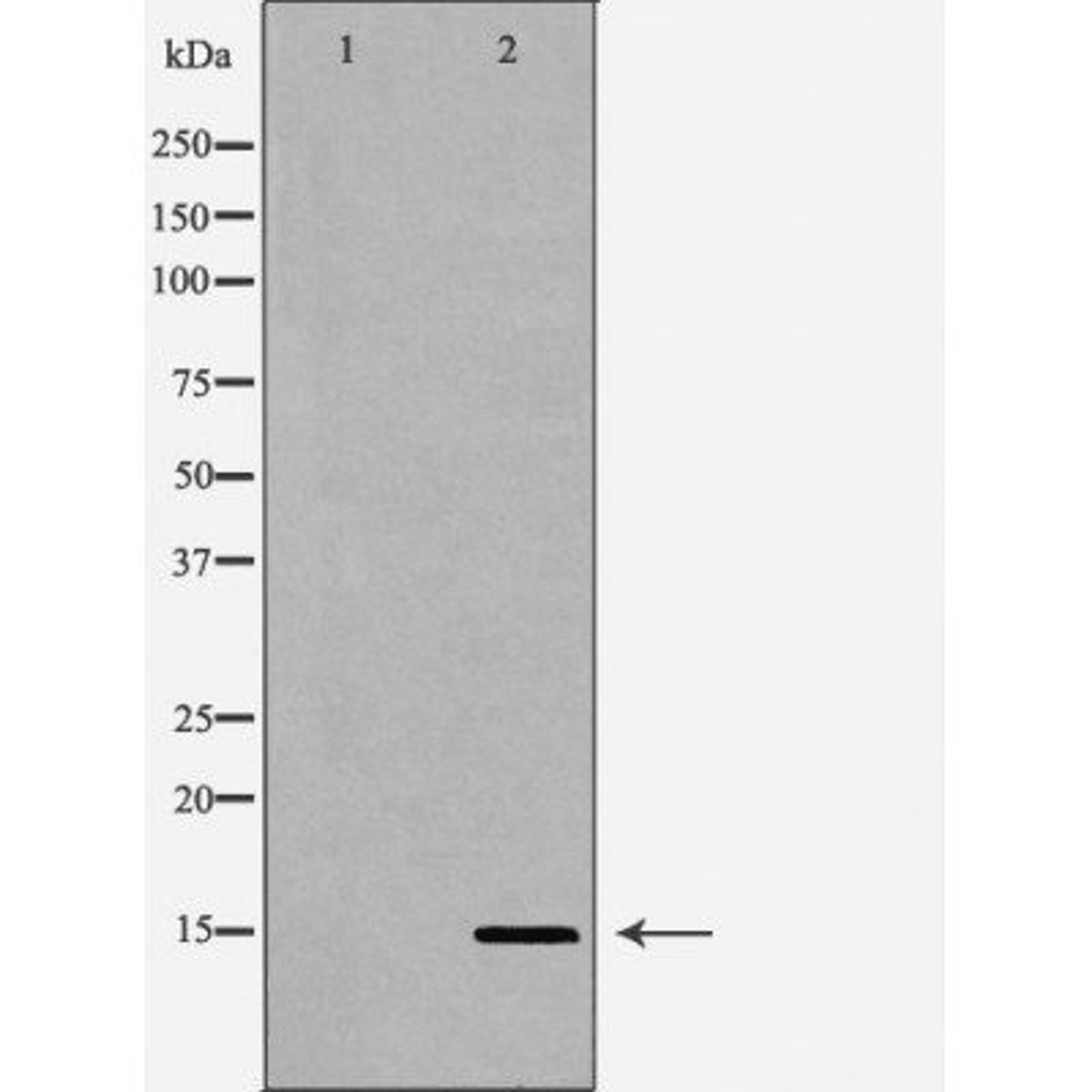 Western blot analysis of HeLa cell line and H3 protein expressed in E.coli using Histone H3R2me2s antibody