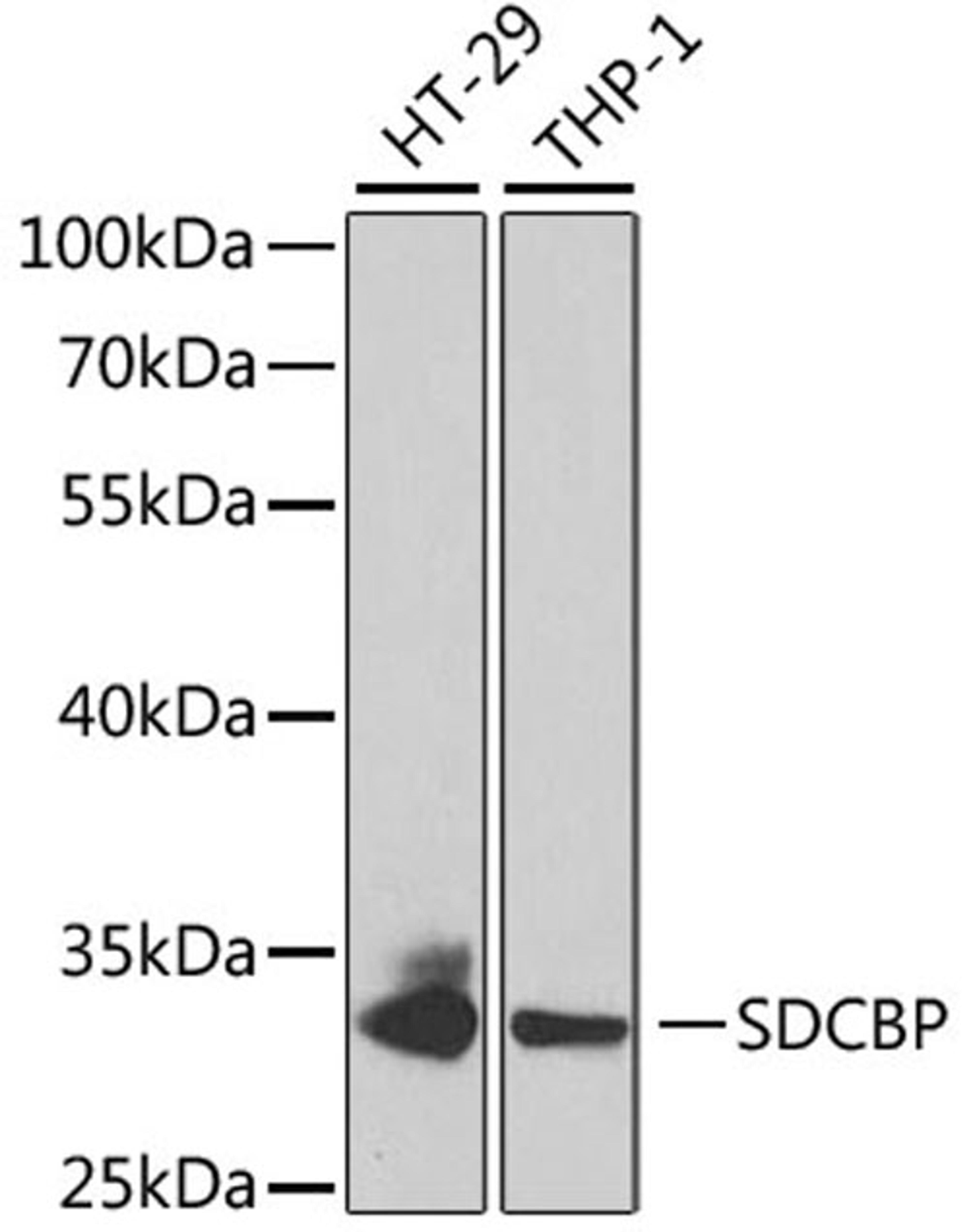 Western blot - SDCBP antibody (A5360)