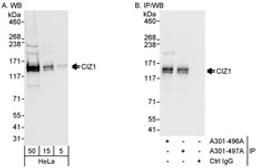 Detection of human CIZ1 by western blot and immunoprecipitation.