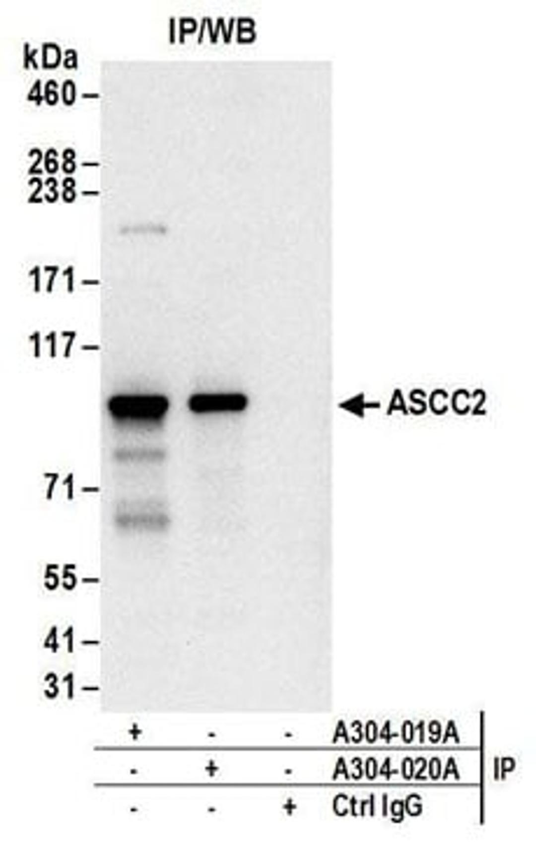 Detection of human ASCC2 by western blot of immunoprecipitates.