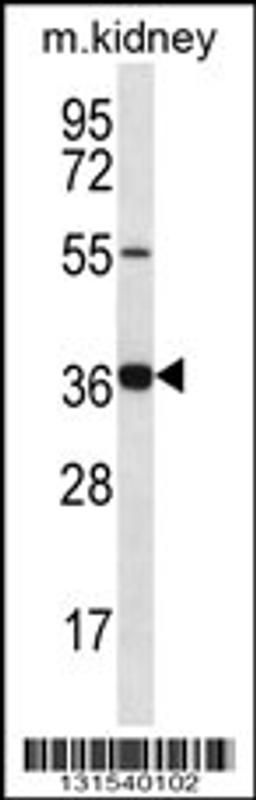 Western blot analysis in mouse kidney tissue lysates (35ug/lane).