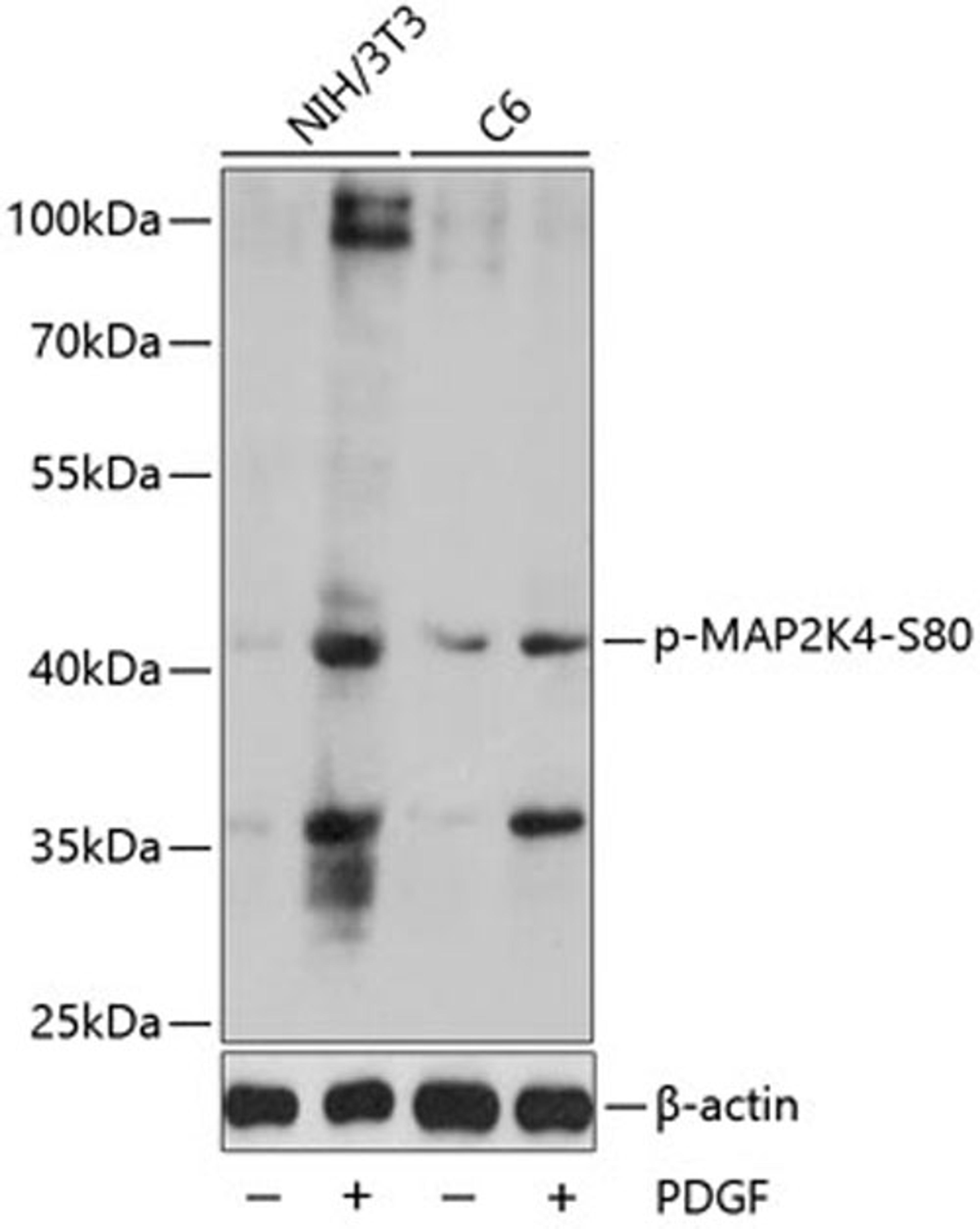 Western blot - Phospho-MAP2K4-S80 antibody (AP0067)