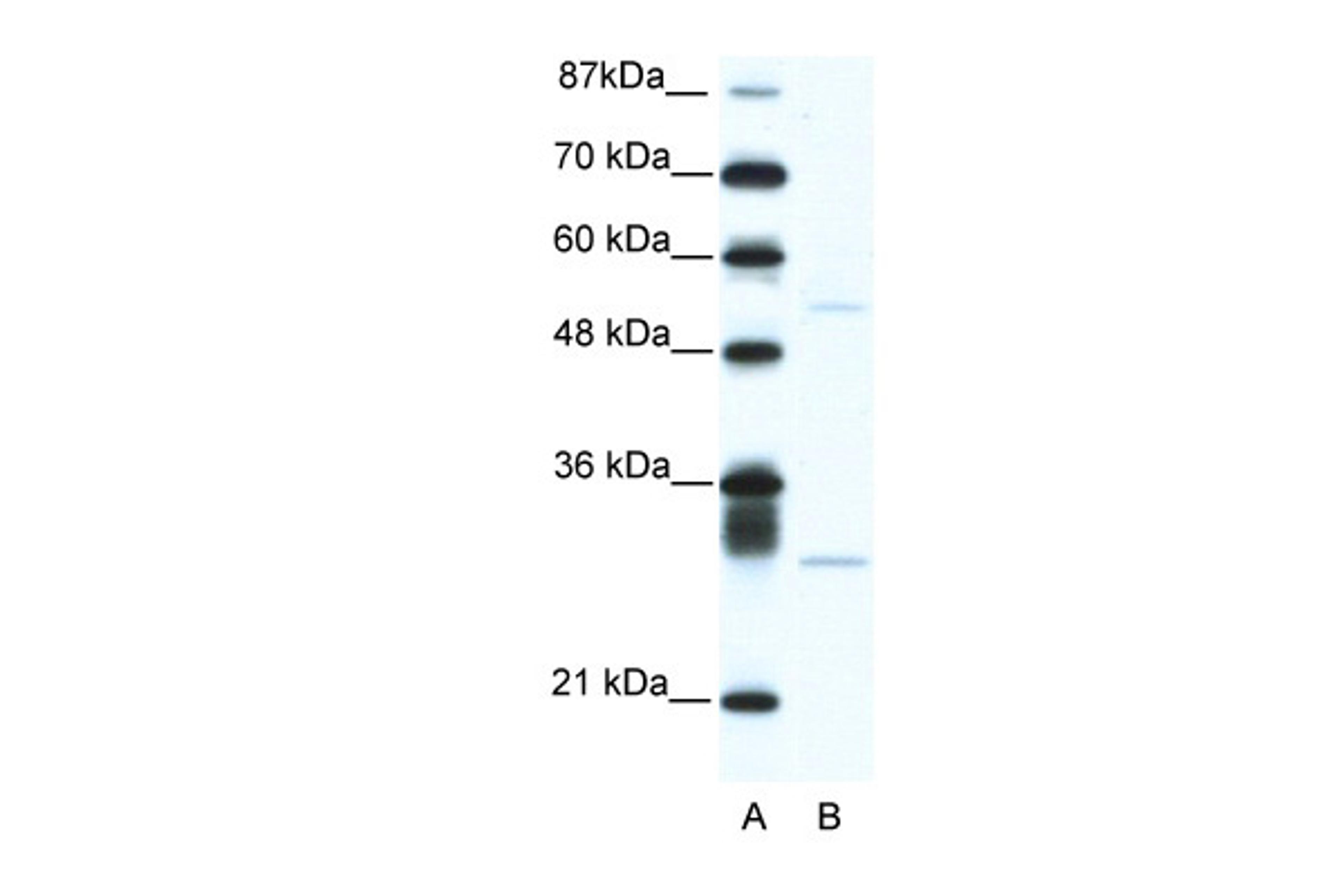 Antibody used in WB on Human Jurkat 5.0 ug/ml.