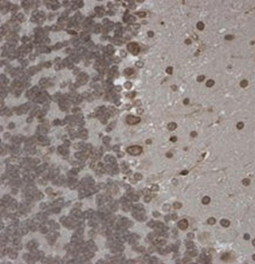 IHC-P of mouse brain of the nuclear membrane of every cell using TrpM7 antibody