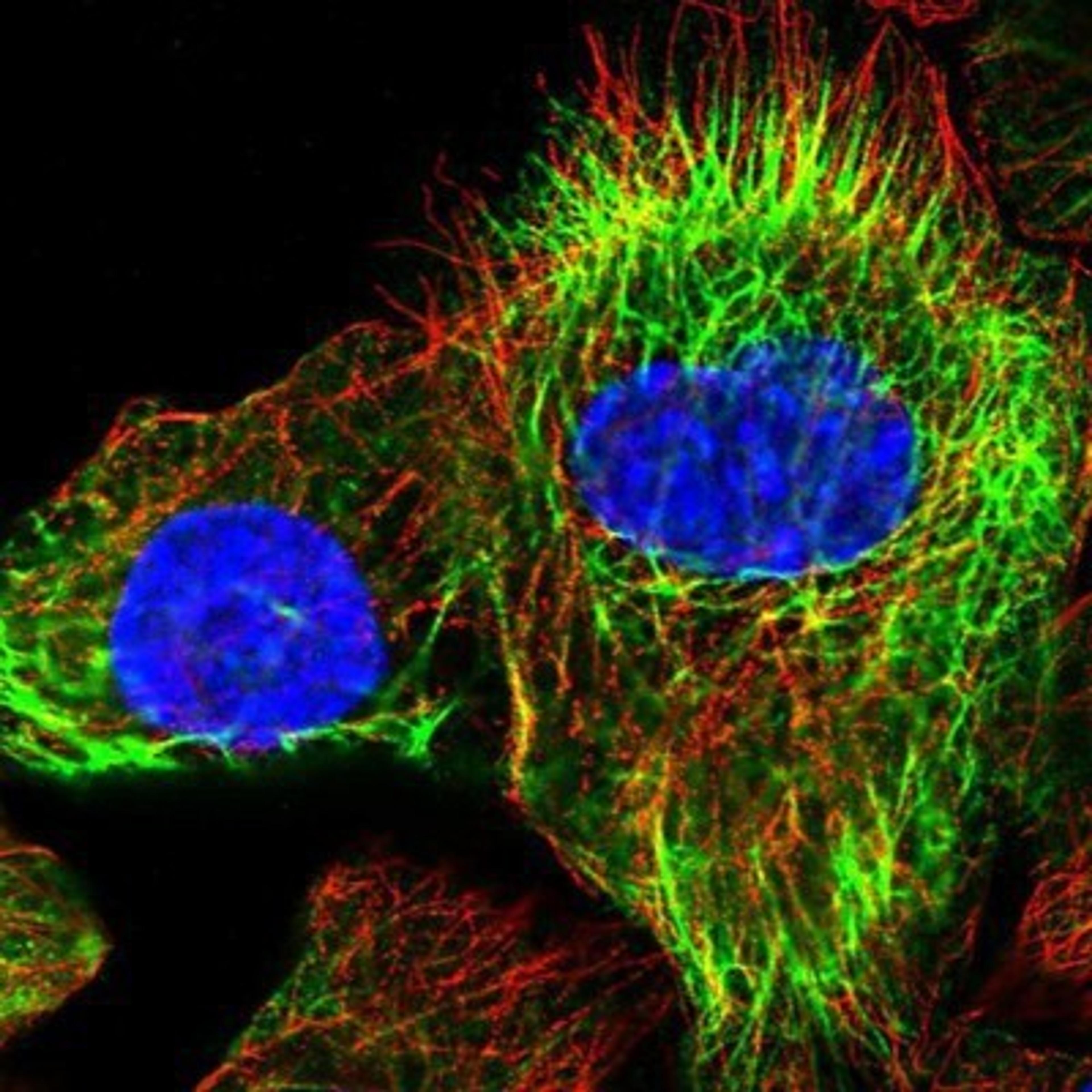 Immunocytochemistry/Immunofluorescence: KRT24 Antibody [NBP1-83665] - Staining of human cell line A-431 shows positivity in cytoskeleton (intermediate filaments).