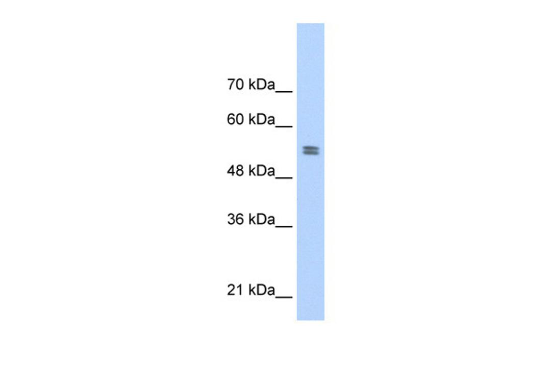 Antibody used in WB on Human Daudi cells at 0.2-1 ug/ml.