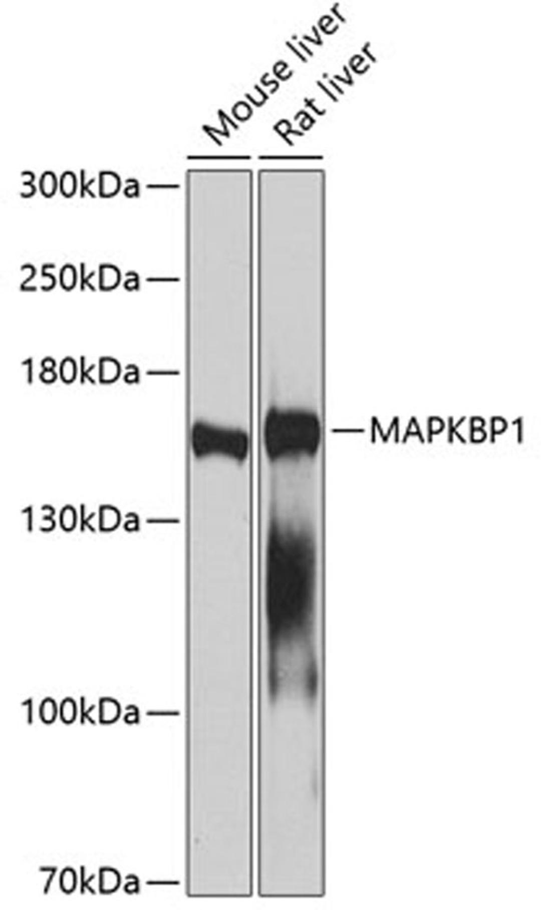 Western blot - MAPKBP1 antibody (A2626)