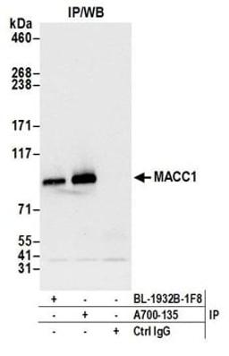 Detection of human MACC1 by western blot of immunoprecipitates. Samples: Whole cell lysate (1.0 mg per IP reaction; 20% of IP loaded) from SW-620 cells prepared using NETN lysis buffer.