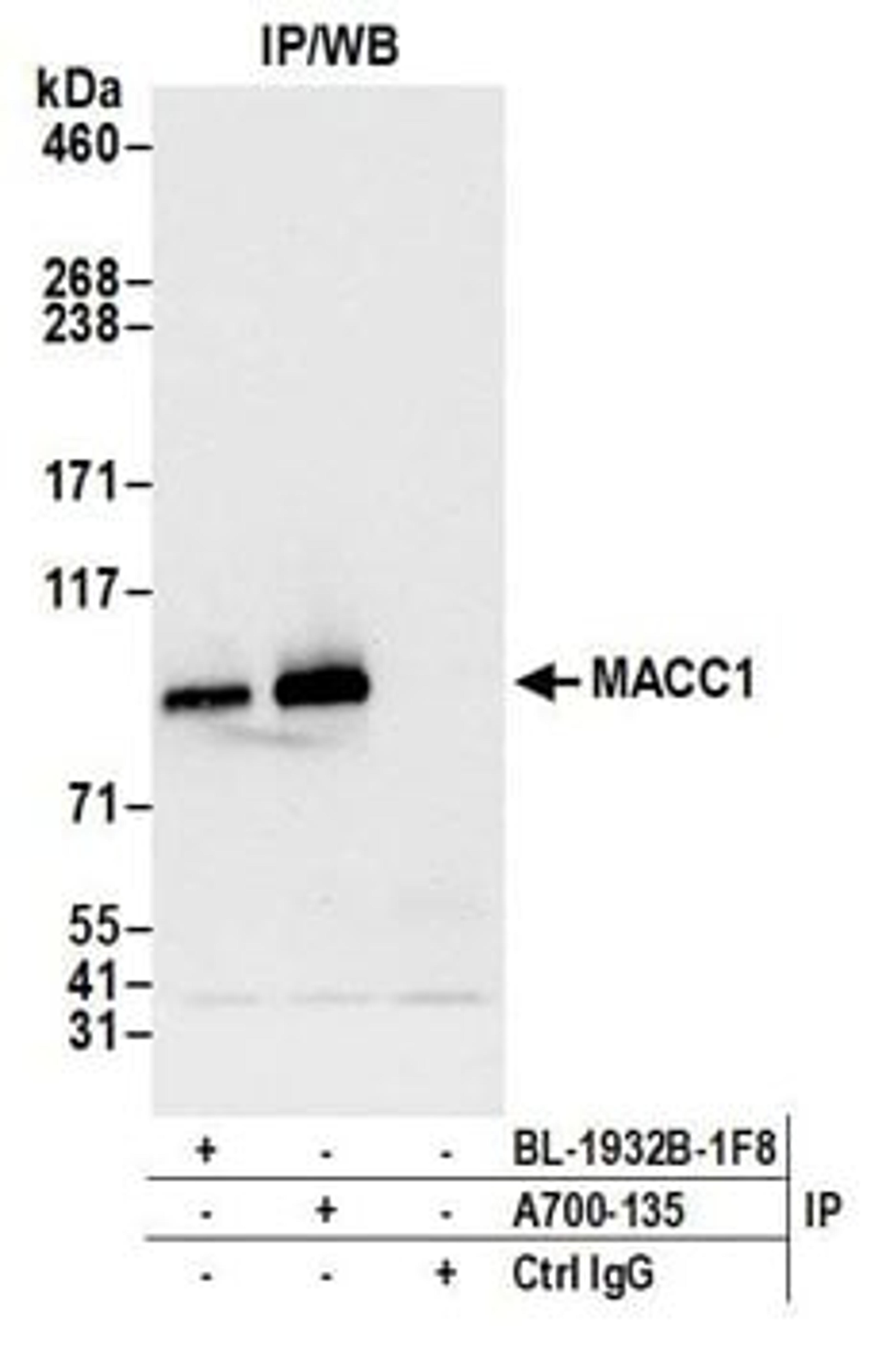 Detection of human MACC1 by western blot of immunoprecipitates. Samples: Whole cell lysate (1.0 mg per IP reaction; 20% of IP loaded) from SW-620 cells prepared using NETN lysis buffer.