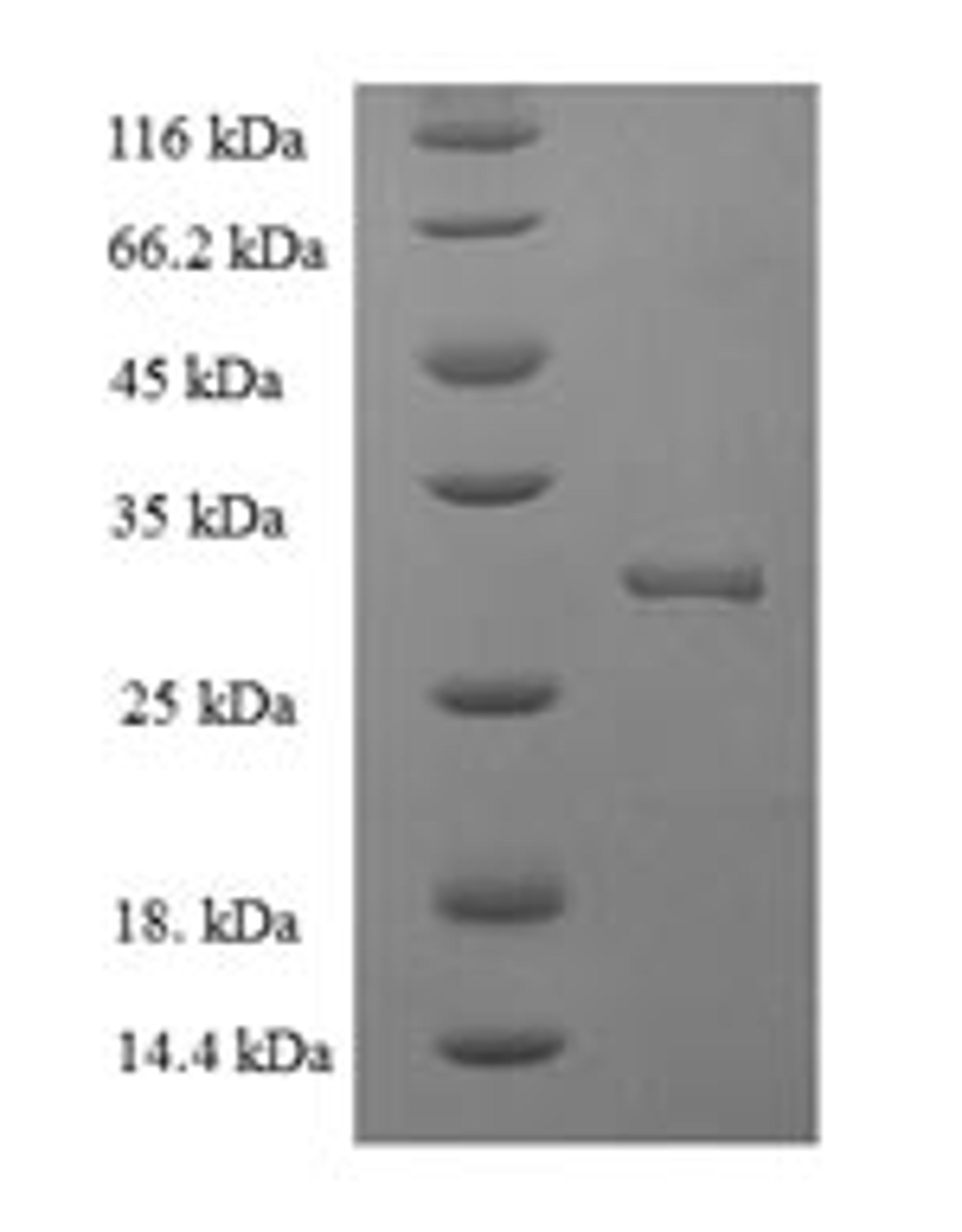 (Tris-Glycine gel) Discontinuous SDS-PAGE (reduced) with 5% enrichment gel and 15% separation gel.