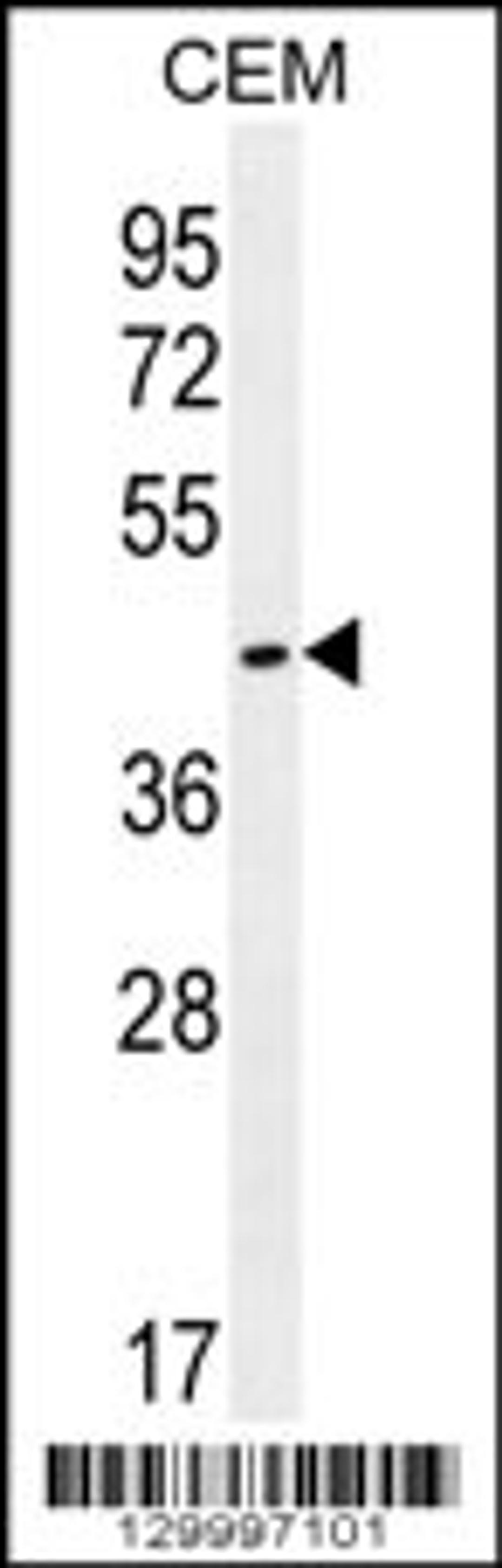 Western blot analysis in CEM cell line lysates (35ug/lane).