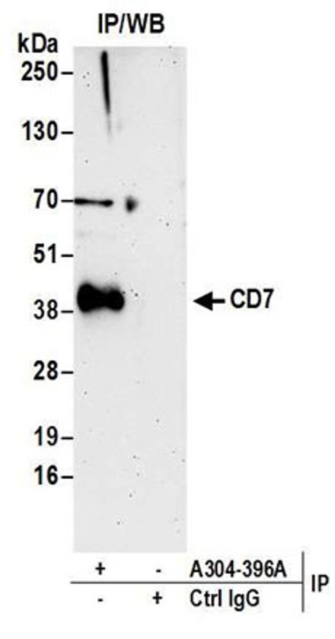 Detection of human CD7 by western blot of immunoprecipitates.