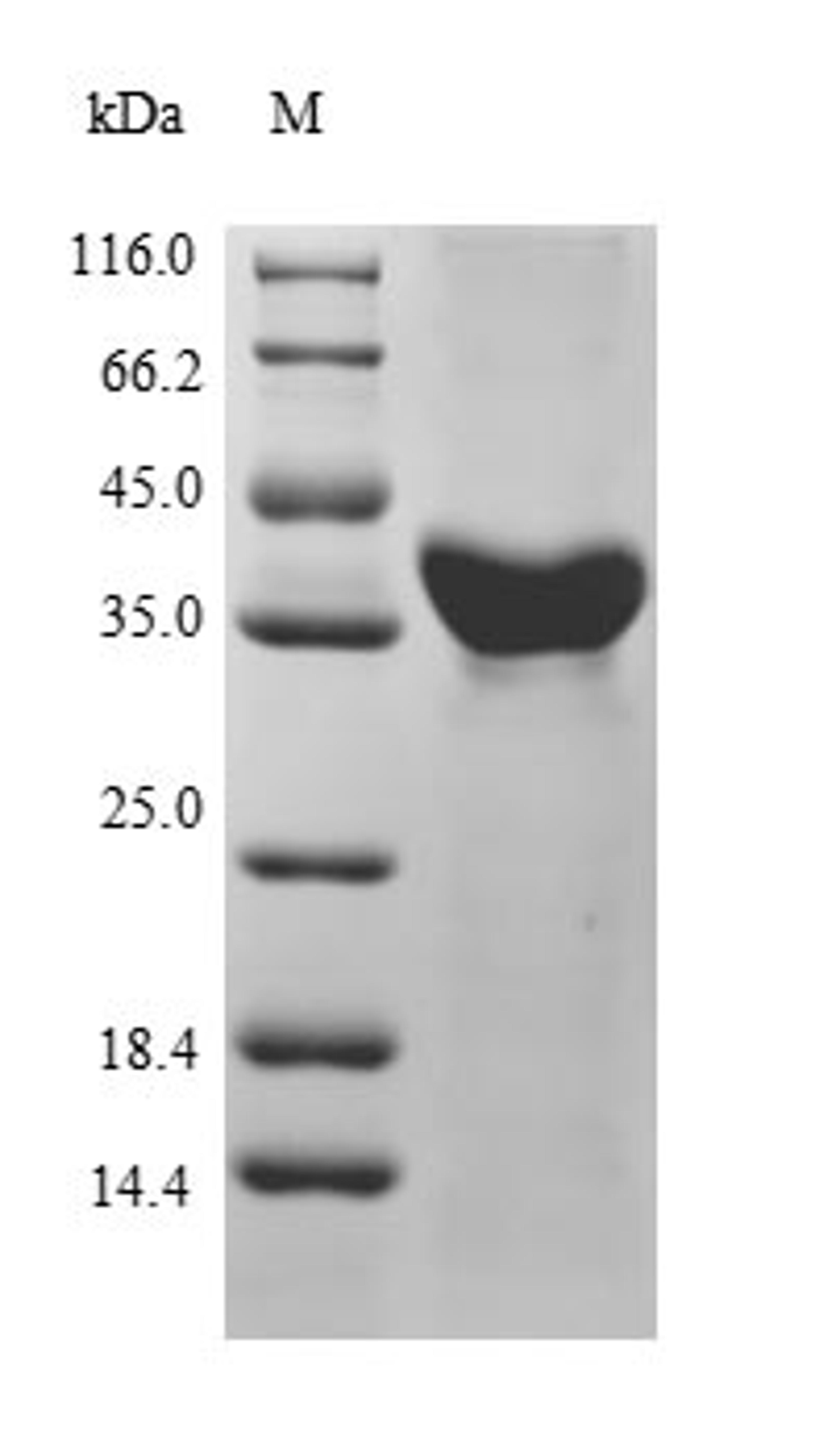 (Tris-Glycine gel) Discontinuous SDS-PAGE (reduced) with 5% enrichment gel and 15% separation gel.