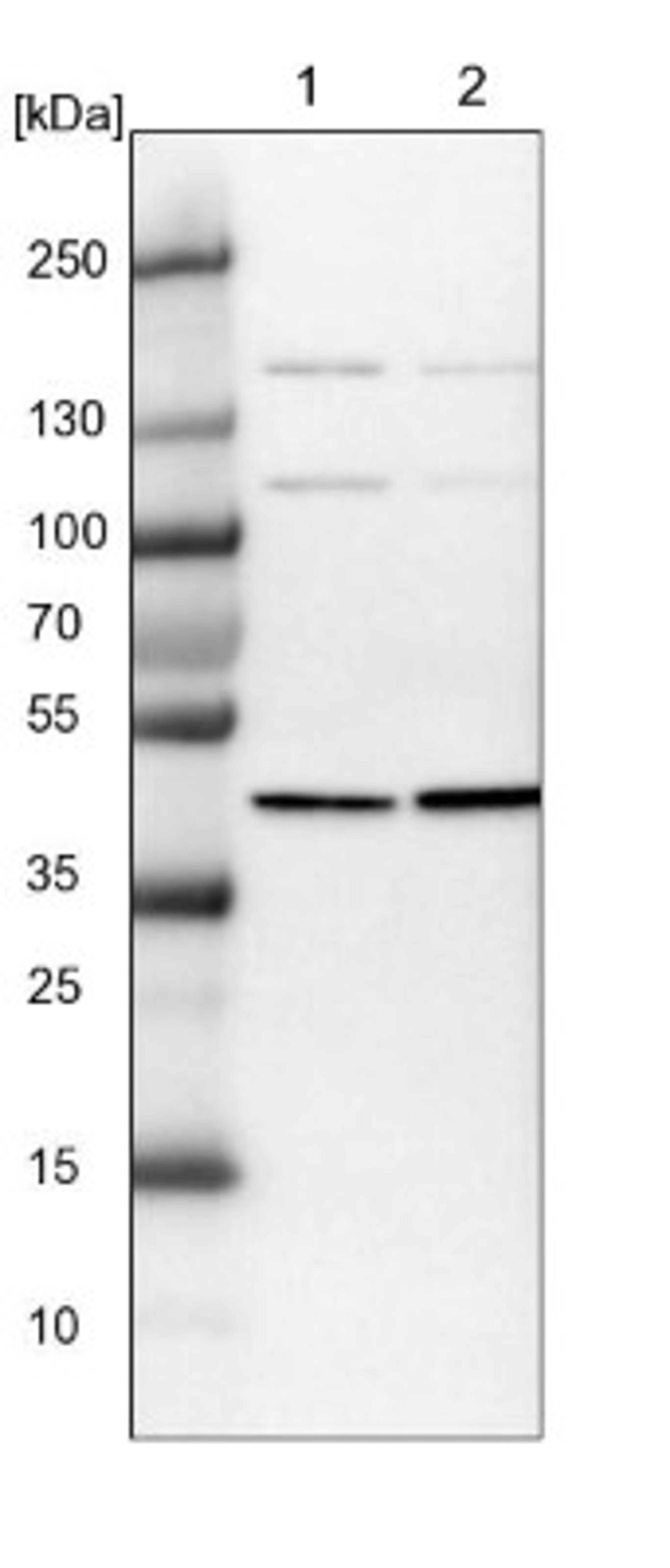 Western Blot: PSMD6 Antibody [NBP1-81545] - Lane 1: NIH-3T3 cell lysate (Mouse embryonic fibroblast cells)<br/>Lane 2: NBT-II cell lysate (Rat Wistar bladder tumour cells)