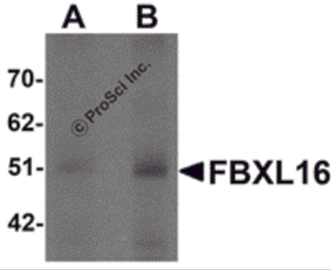 Western blot analysis of FBXL16 in human spleen tissue lysate with FBXL16 antibody at (A) 0.5 and (B) 1 &#956;g/mL.