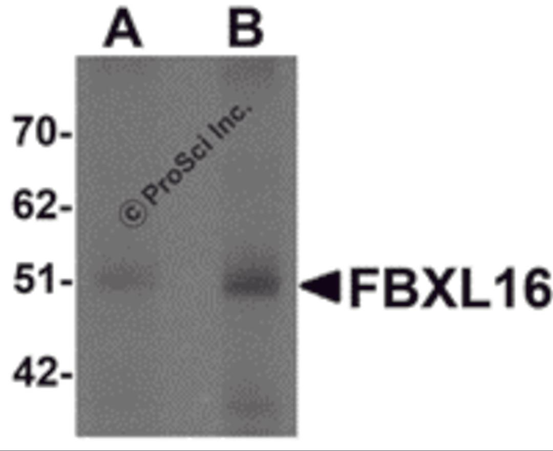Western blot analysis of FBXL16 in human spleen tissue lysate with FBXL16 antibody at (A) 0.5 and (B) 1 μg/mL.