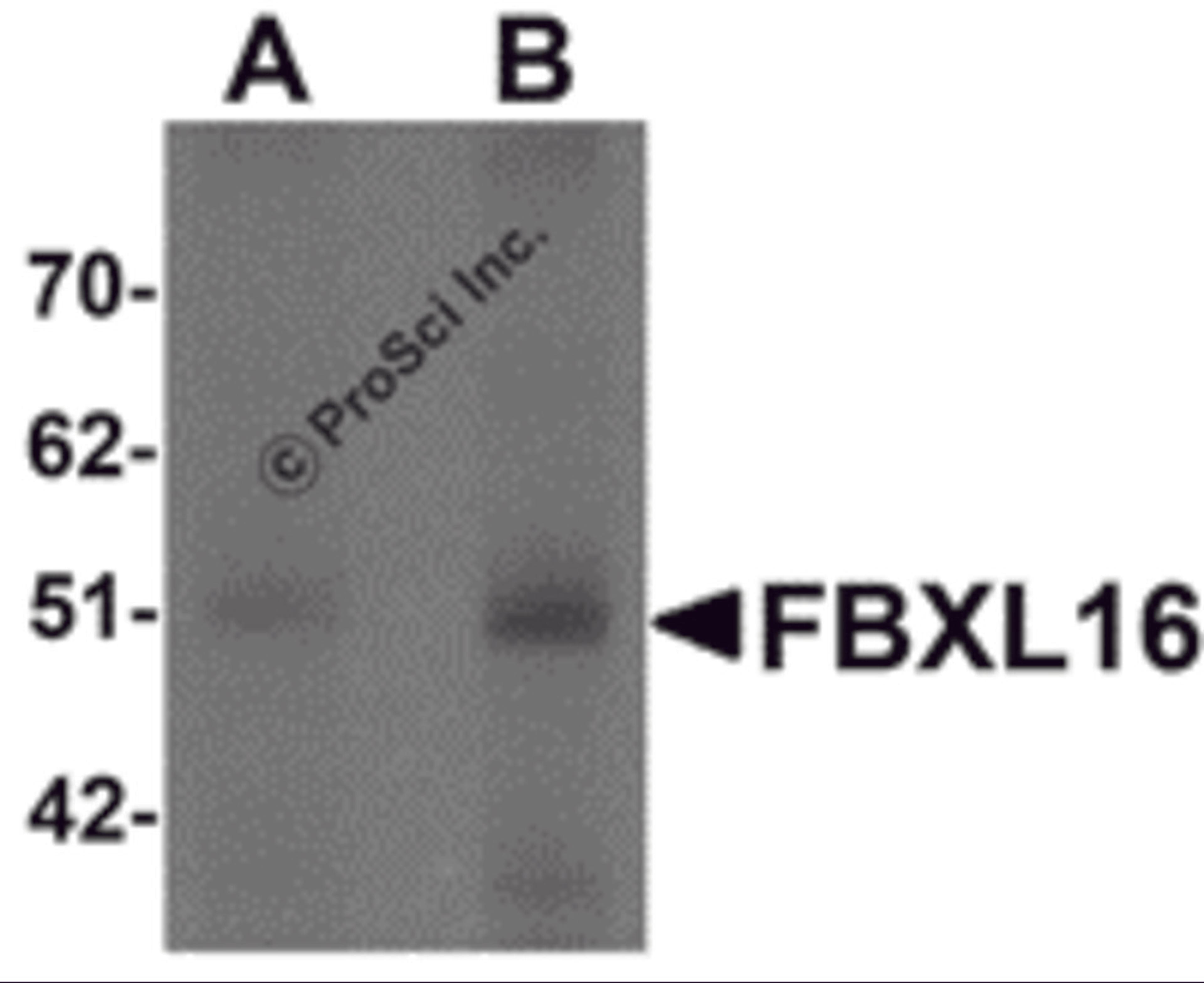 Western blot analysis of FBXL16 in human spleen tissue lysate with FBXL16 antibody at (A) 0.5 and (B) 1 μg/mL.