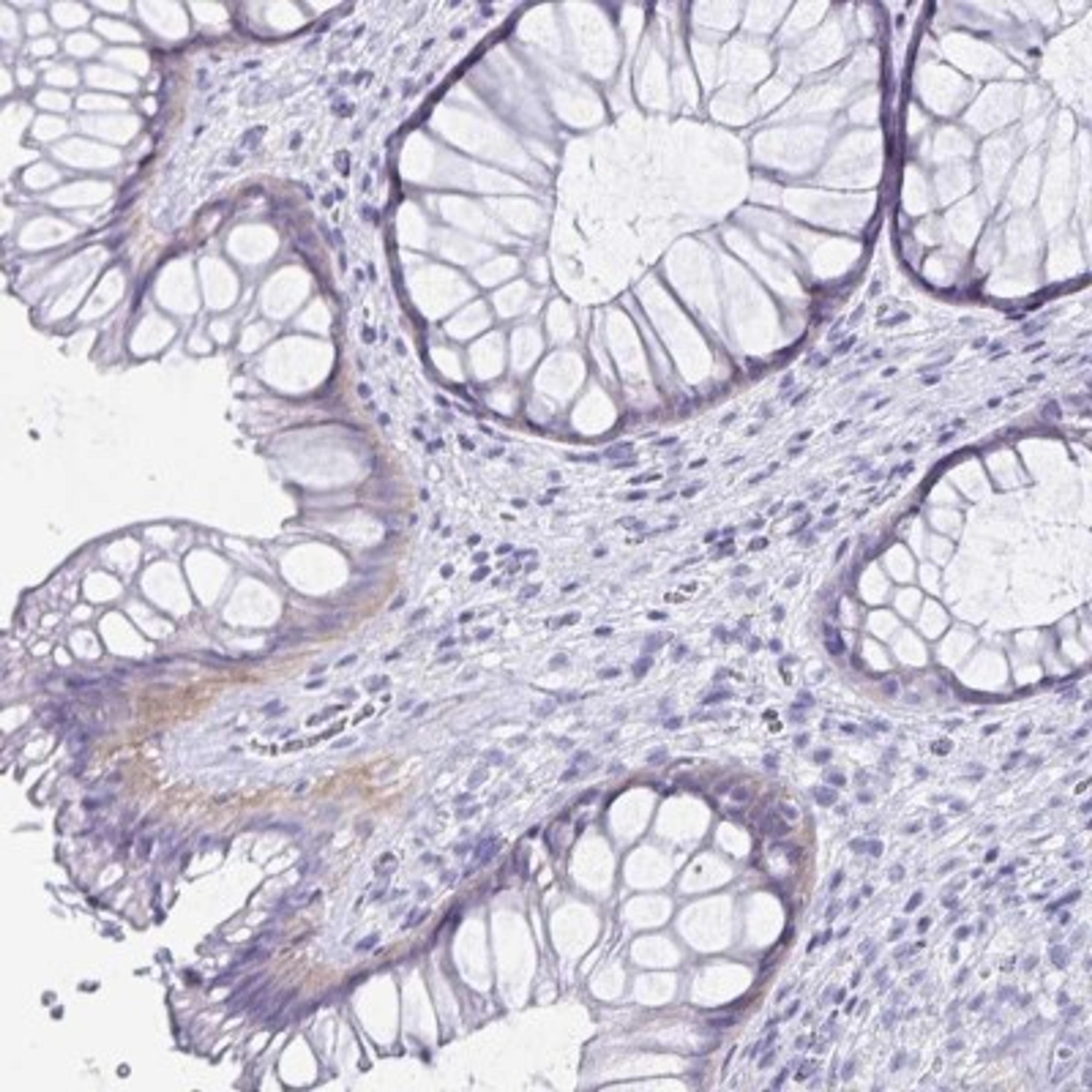 Immunohistochemistry: C19orf73 Antibody [NBP2-32367] - Immunohistochemical staining of human rectum shows weak cytoplasmic positivity in glandular cells.