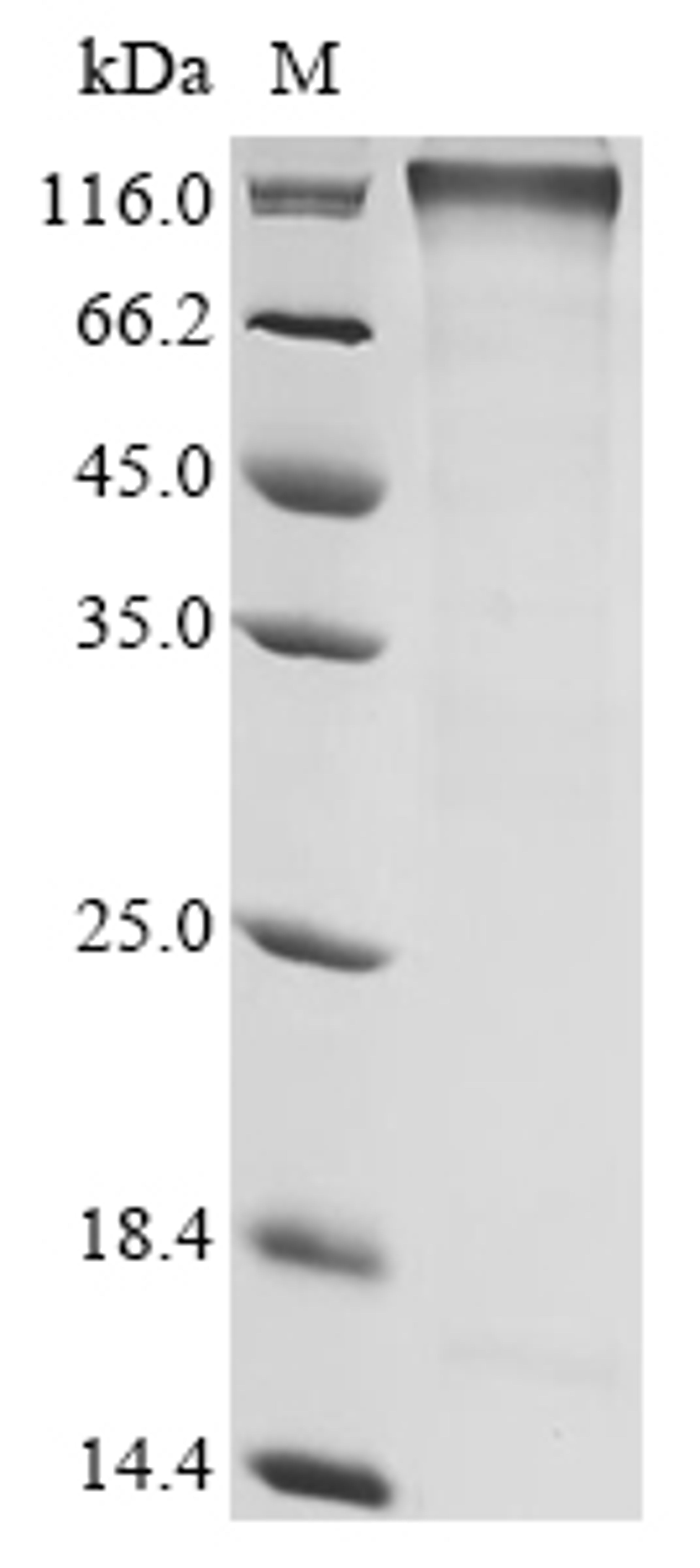 (Tris-Glycine gel) Discontinuous SDS-PAGE (reduced) with 5% enrichment gel and 15% separation gel.