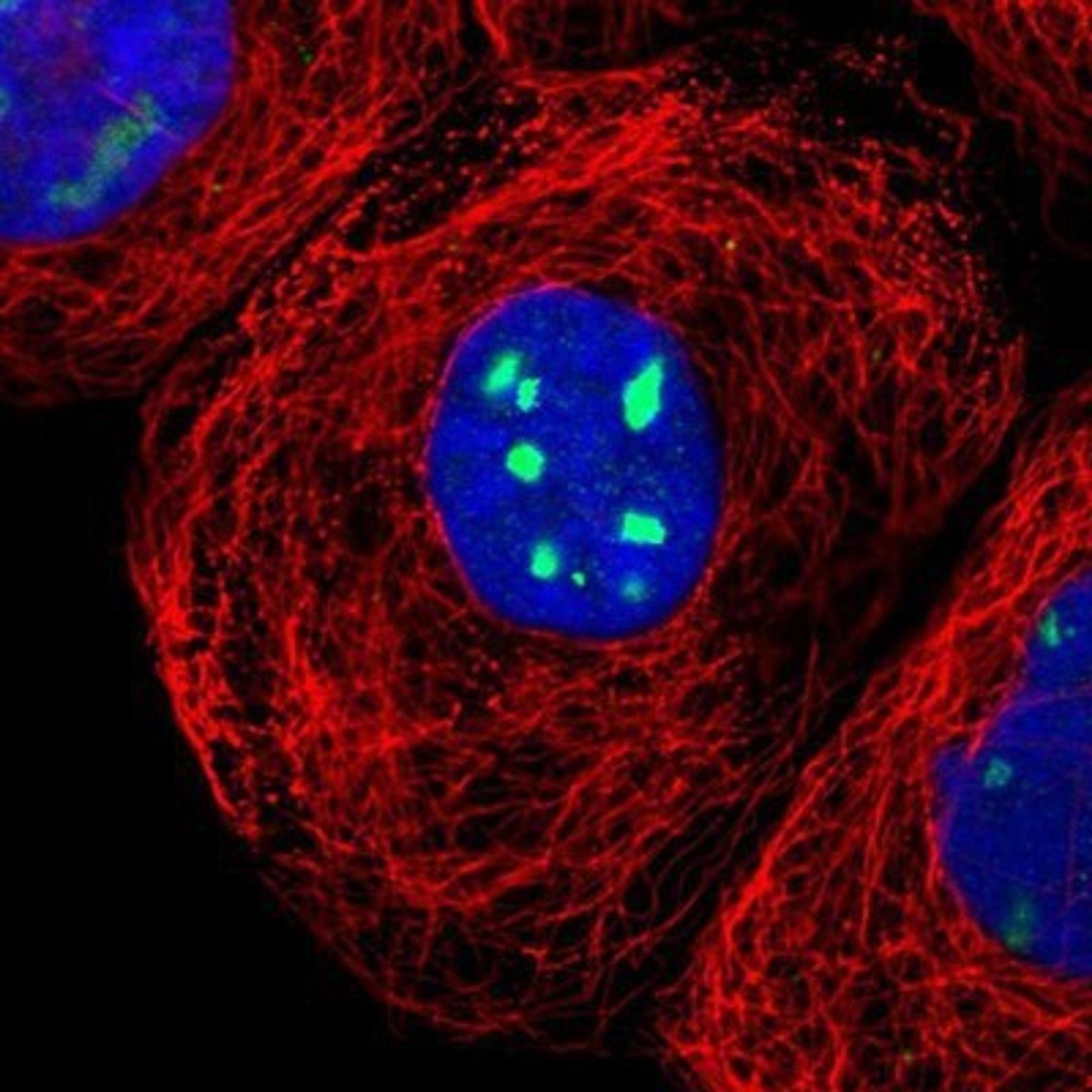 Immunocytochemistry/Immunofluorescence: RRP1 Antibody [NBP1-85338] - Staining of human cell line A-431 shows positivity in nucleoli.