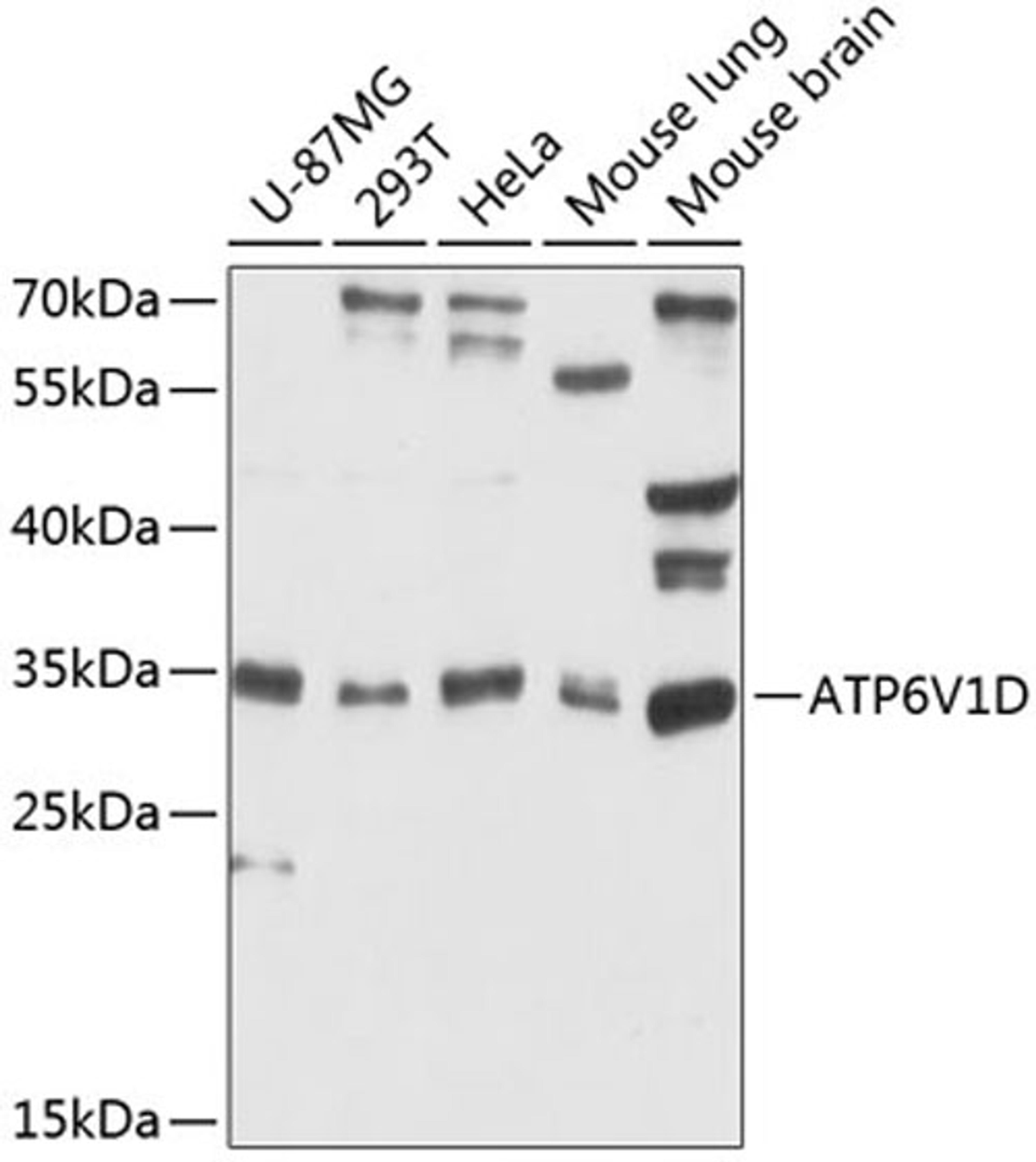 Western blot - ATP6V1D antibody (A12940)