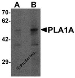 Western blot analysis of PLA1A in human kidney tissue lysate with PLA1A antibody at (A) 1 and (B) 2 μg/mL.